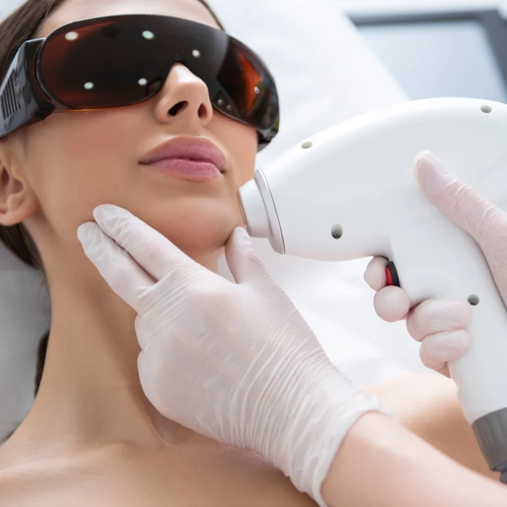 Does Facial Hair Grow Back After Laser Hair Removal Treatment?