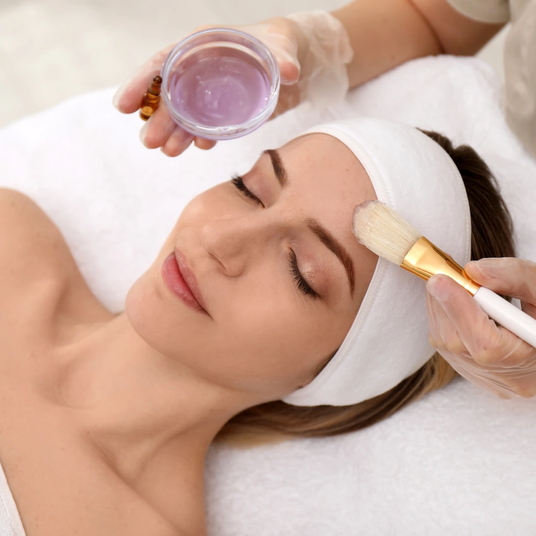 Do Chemical Peels Work for Hyperpigmentation - Choosing the Best Treatment