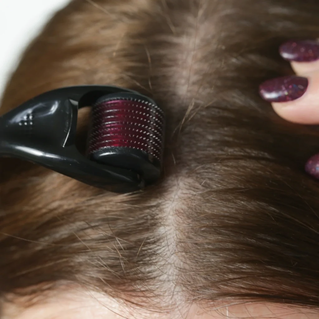 derma roller's transformative benefits for hair
