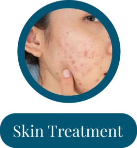 Skin-Treatment
