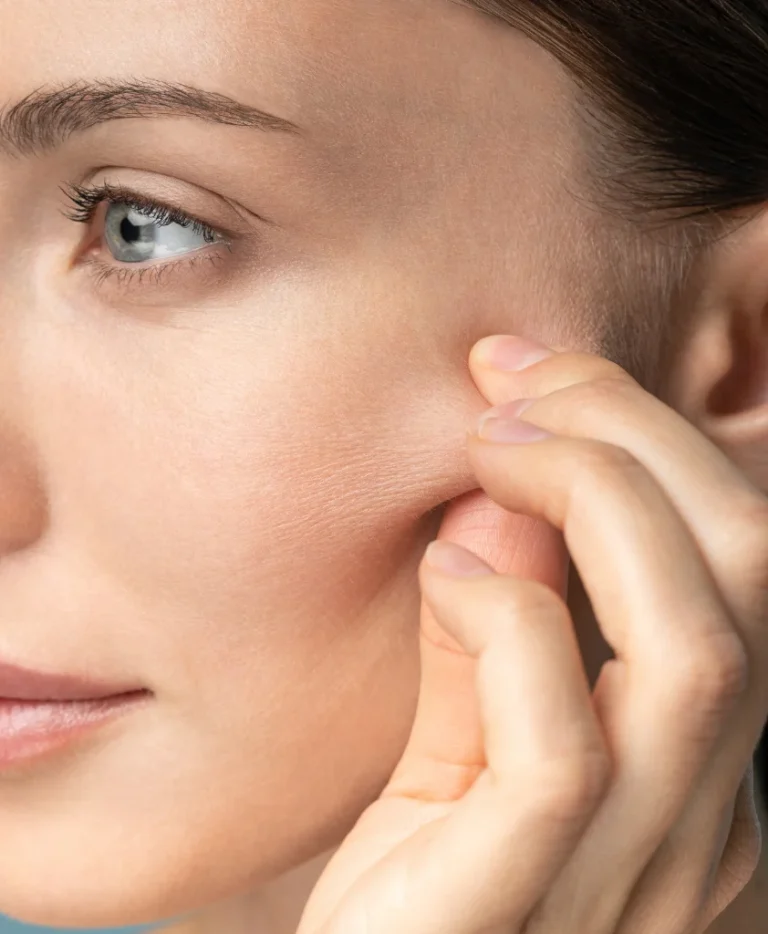 cheek-implant