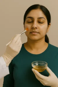 chemical-peel