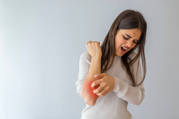 skin allergy treatment image