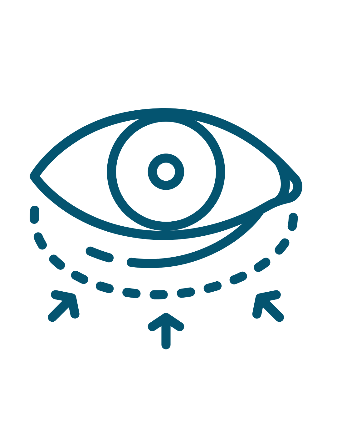 blepharoplasty (1)