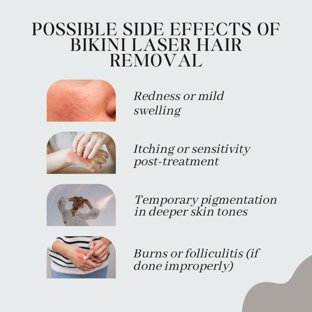 Possible Side Effects of Bikini Laser Hair Removal