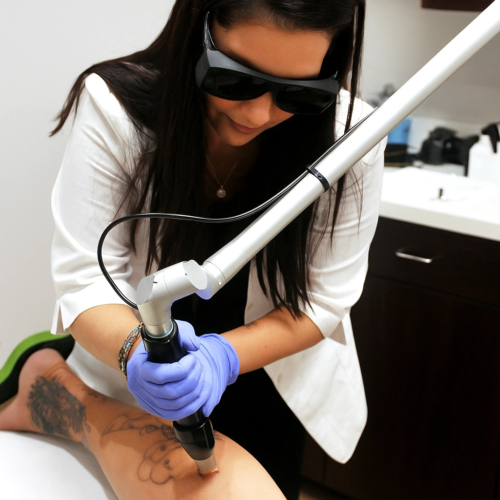tattoo removal