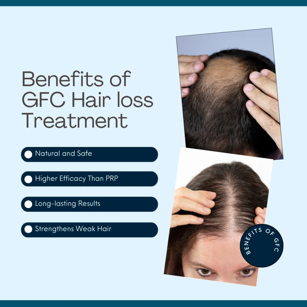 Benefits of GFC Hair loss Treatment