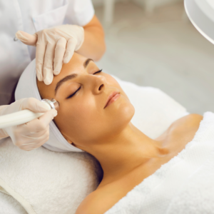 Melasma Laser Treatment image