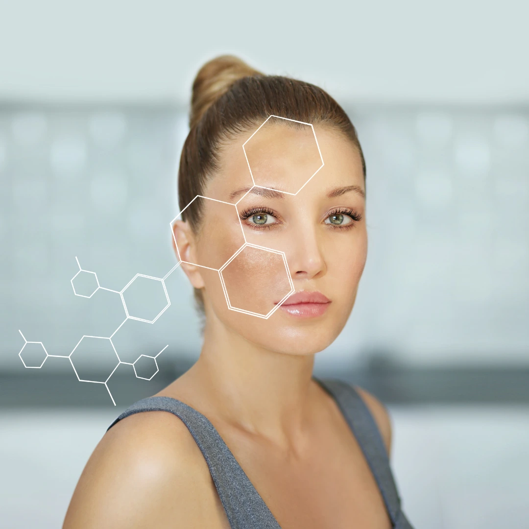best treatment for melasma what really works