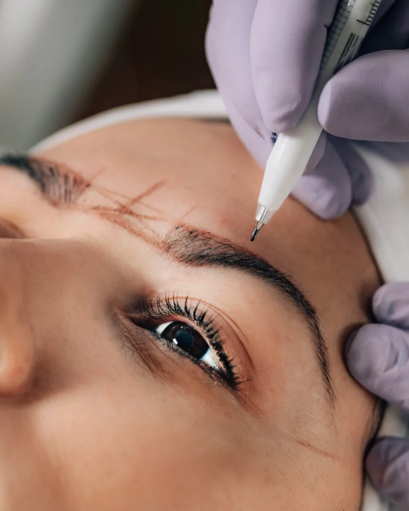 Brow lift