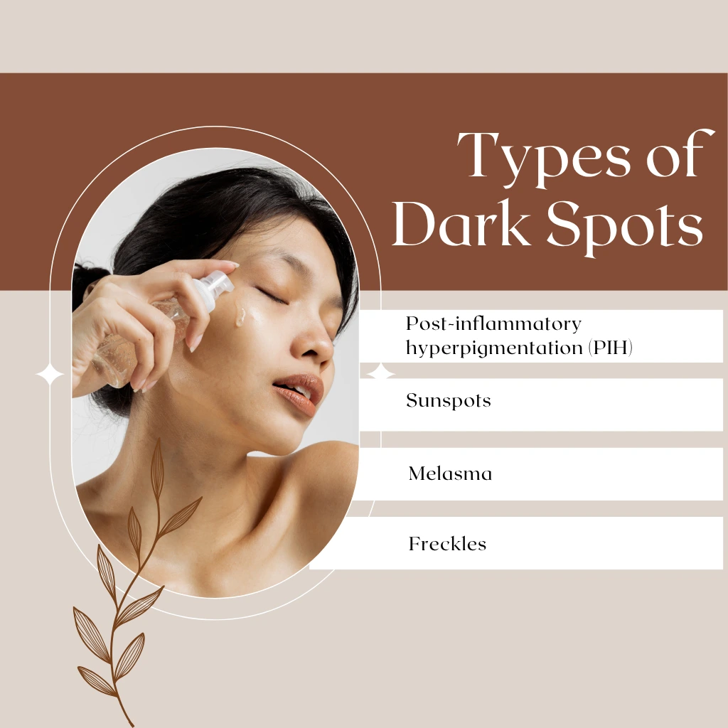 Types of Dark Spots