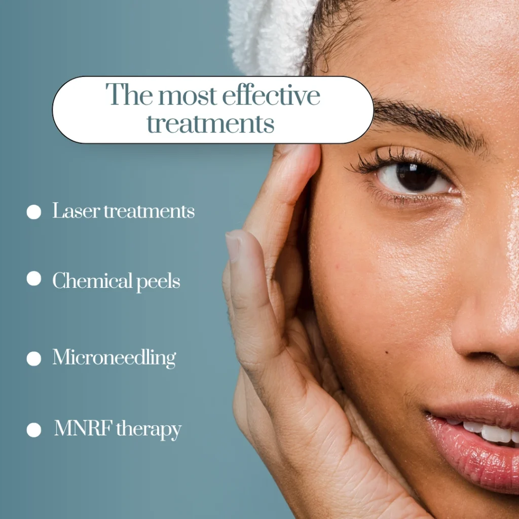 What are the most effective treatments for open pores at skin clinics?