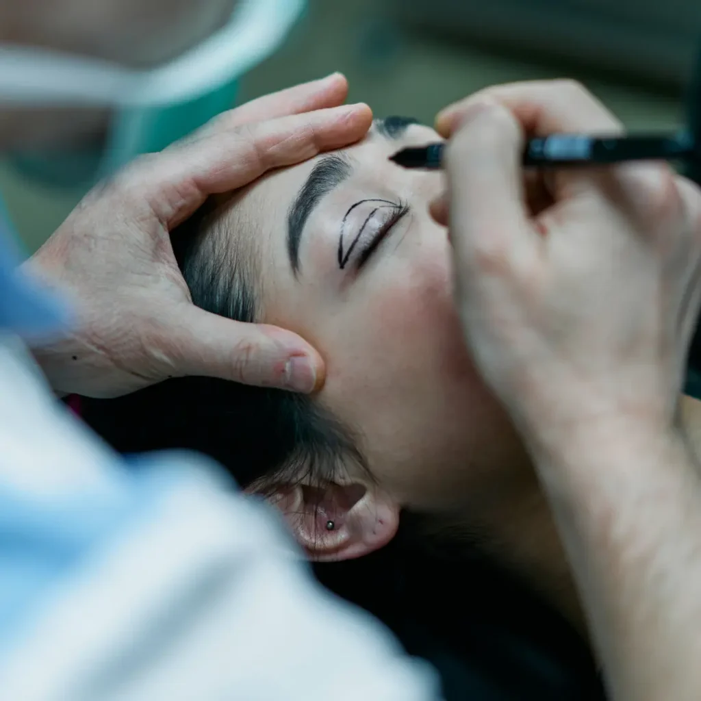 blepharoplasty image