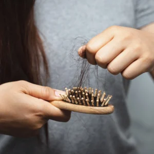 What vitamin deficiency causes hair loss?