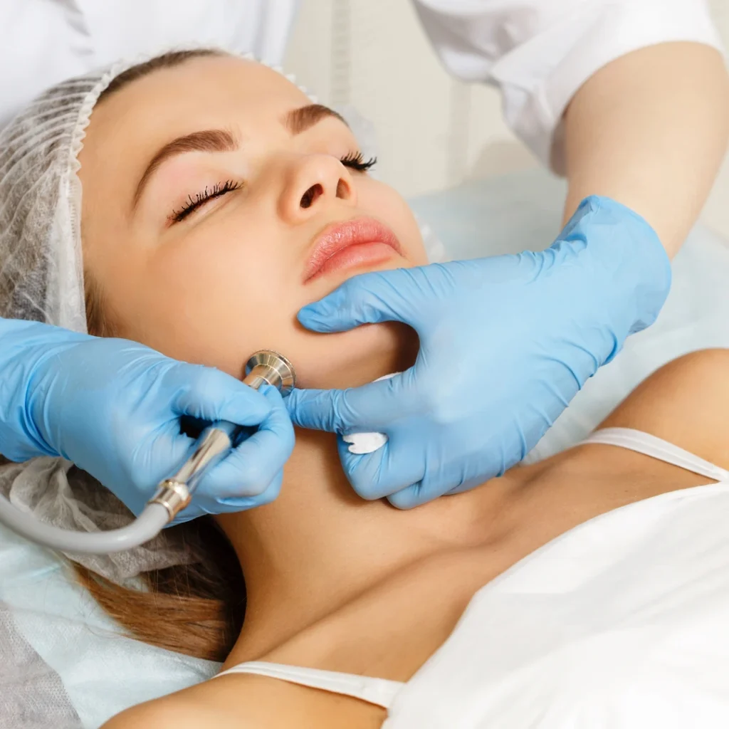Microdermabrasion: Benefits for All Skin Types