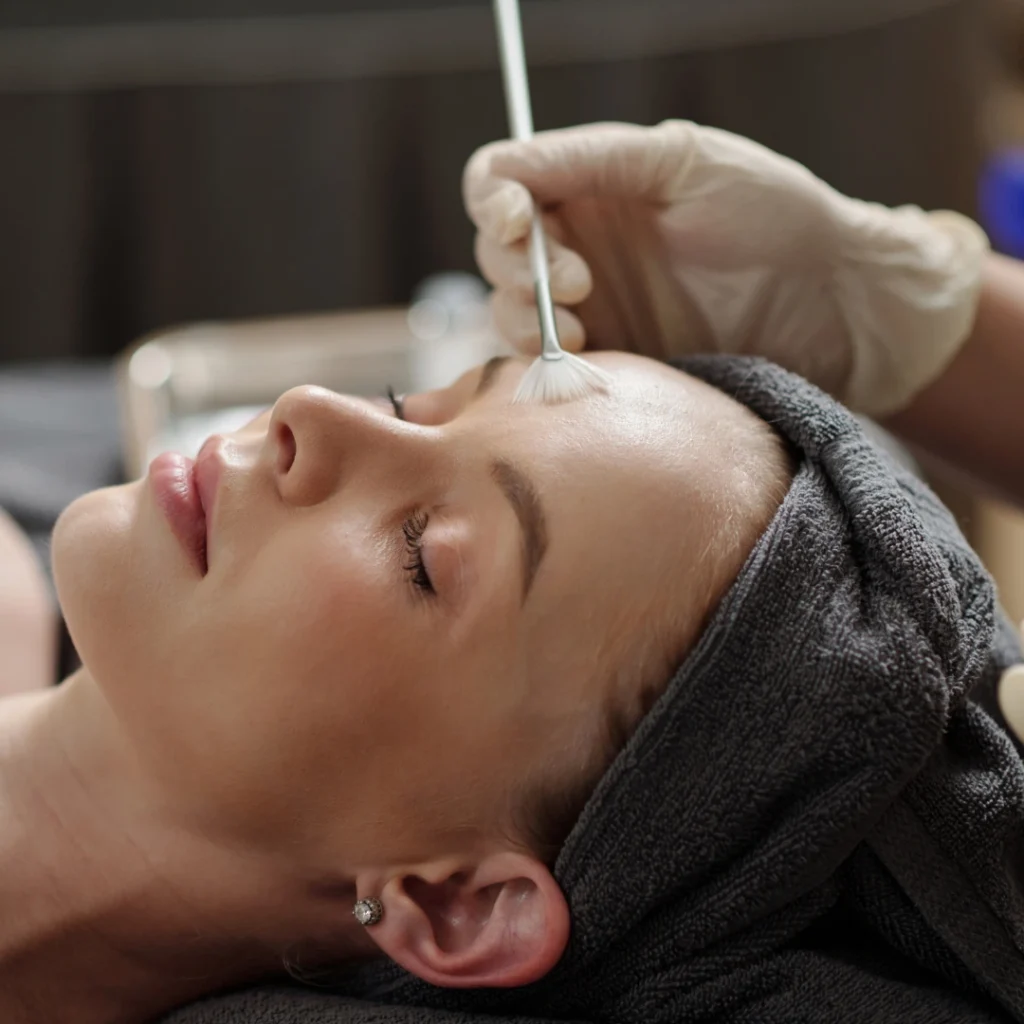 What Happens During a Peel?