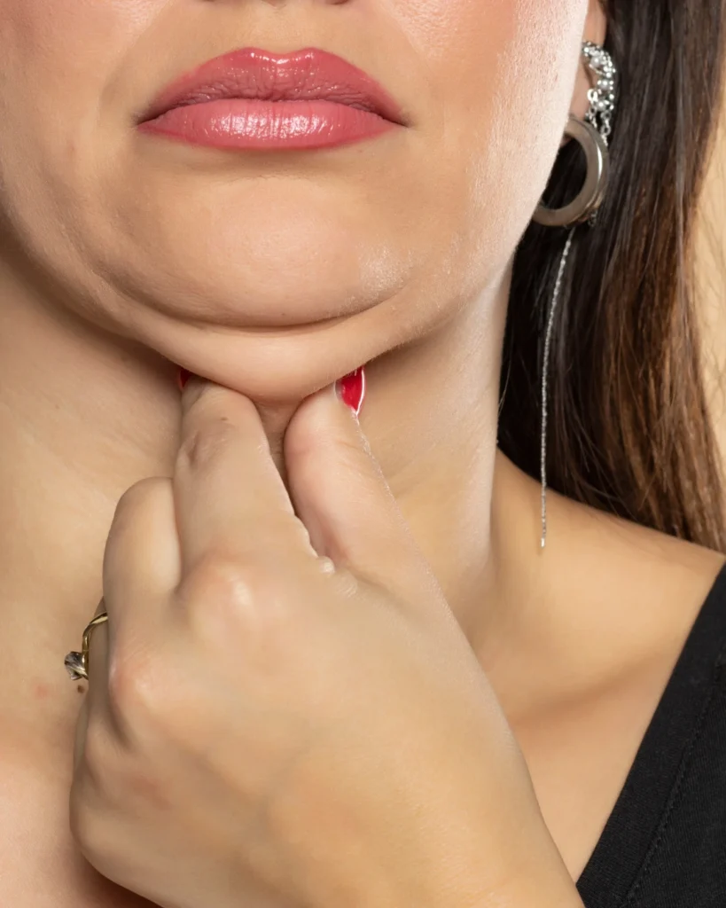 How to Get Rid of a Double Chin Fast