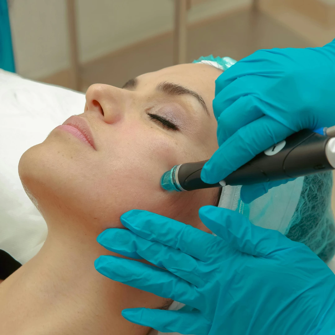 HydraFacial Benefits: Why It Outsmarts Regular Facials