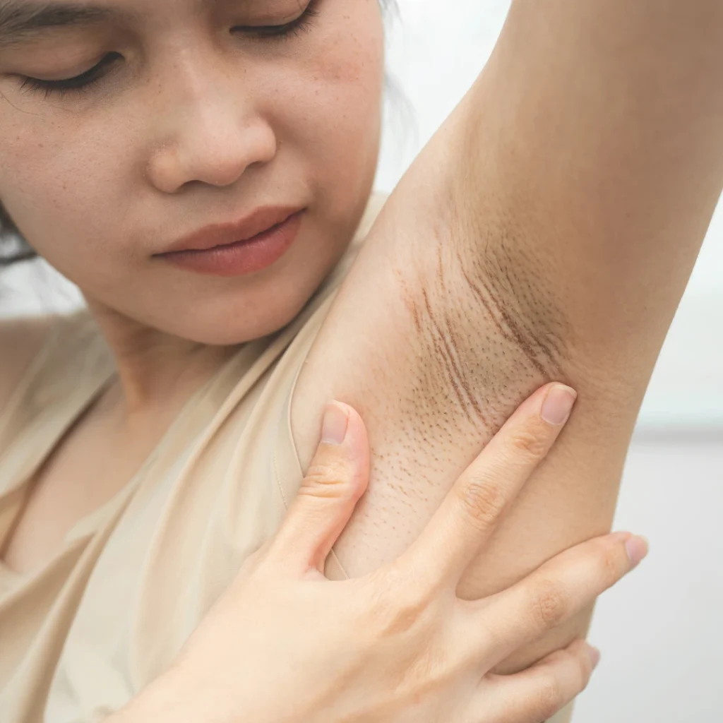 how to whiten underarms remedies, creams, and care tips that work