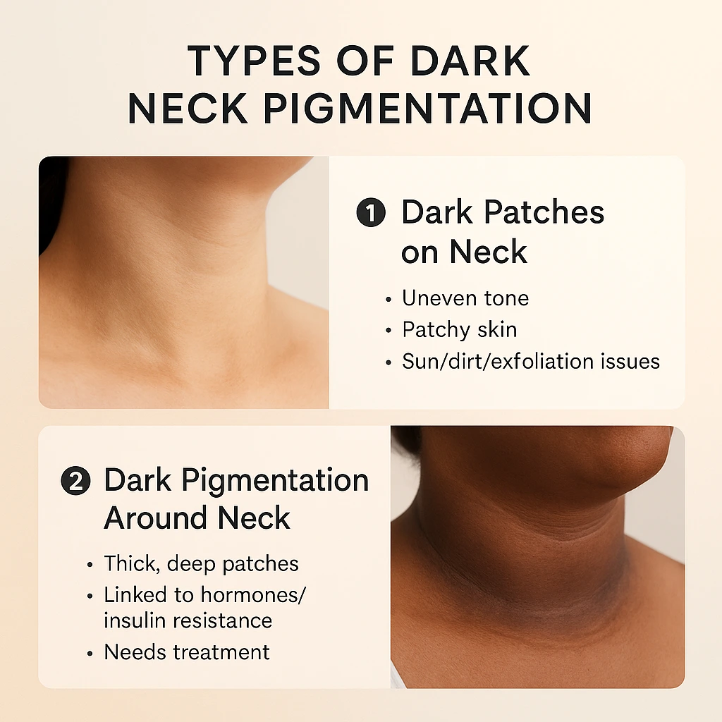 types of dark neck pigmentation