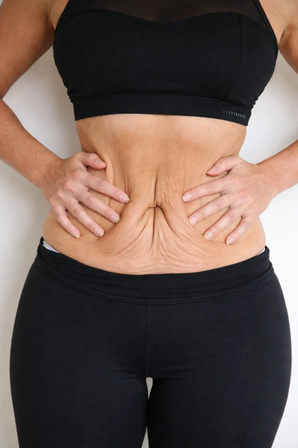 Choose the Best Treatment for Sagging Face Skin