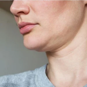 finding the right treatment for sagging face skin