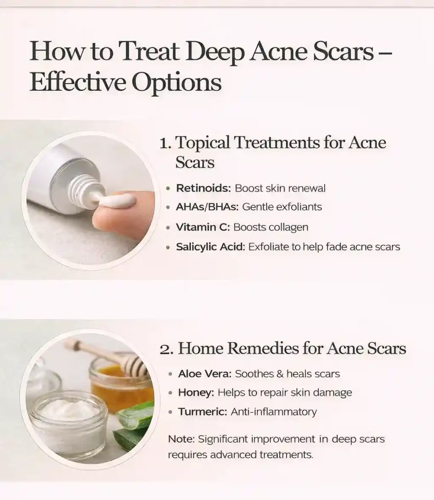 how to treat deep acne scars - effective options_IMGCentury