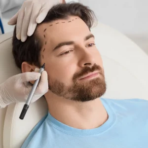 FUE vs FUT Hair Transplant - Cost in India