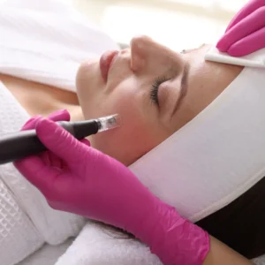 understanding whether microneedling truly delivers results