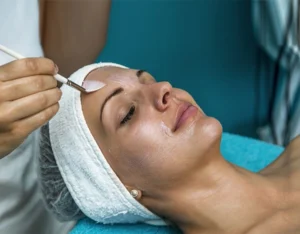 Chemical peel