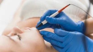 choosing between electrolysis and laser hair removal