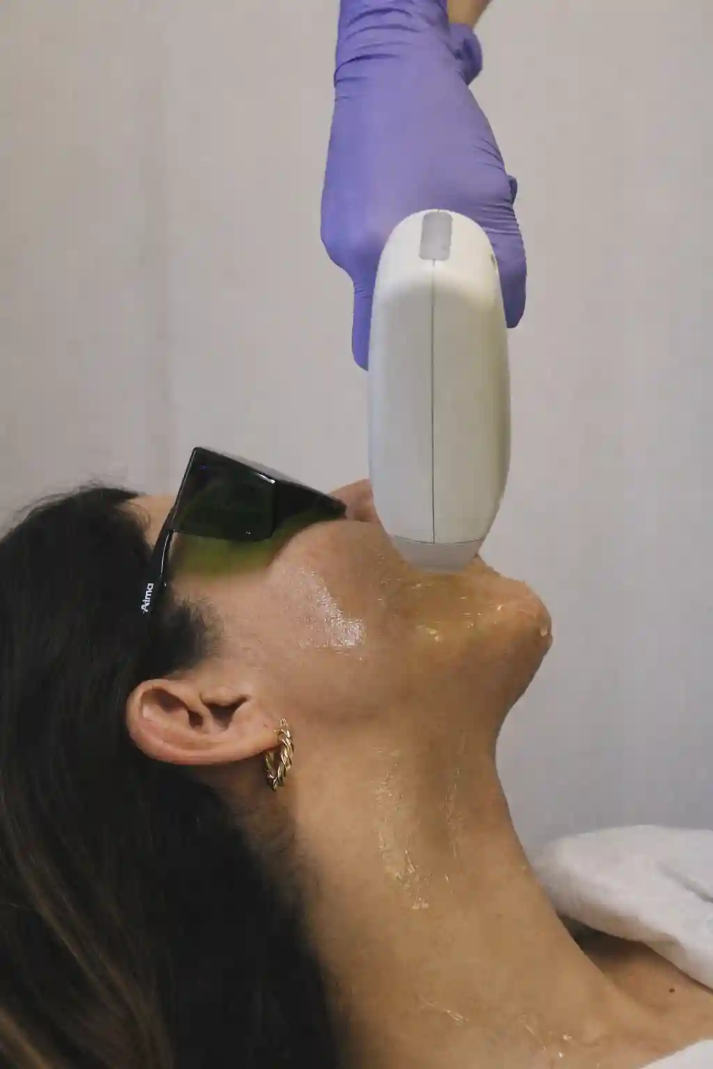 types of laser hair removal - which laser is effective for you