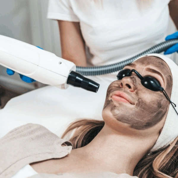 why choose reborn hair and skin clinic for carbon facial peel in pune