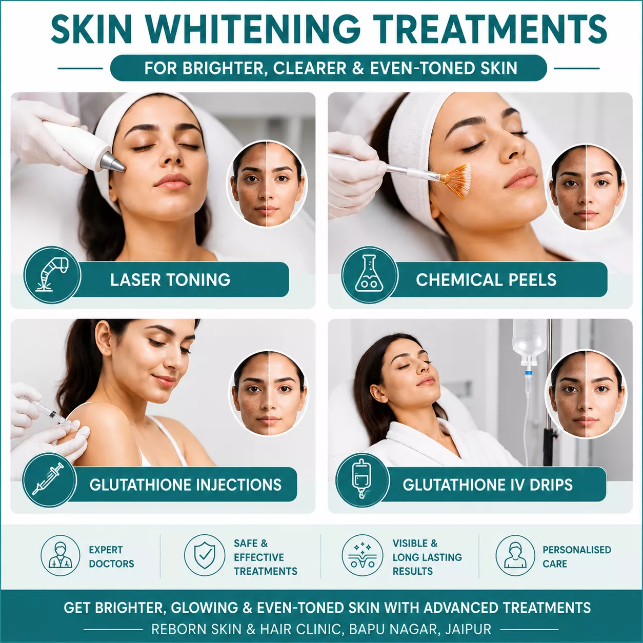 glutathione skin whitening treatment near me Full Body Skin Whitening Treatment in Jaipur Starting at Cost ₹4999 Near Me
