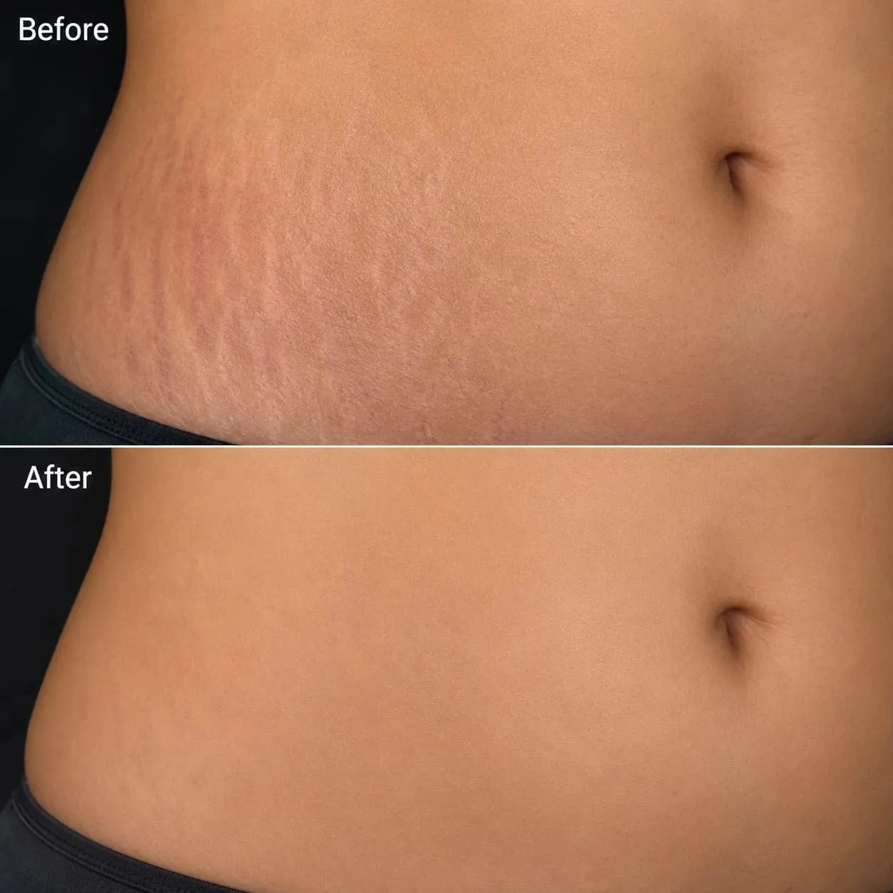 before after image of treatment