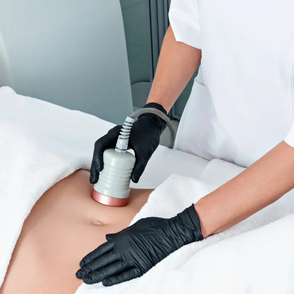 Body-Contouring-Treatment-1