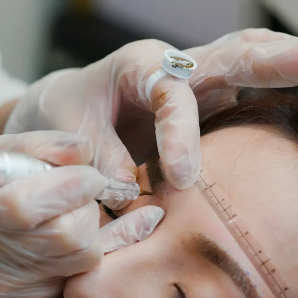 eyebrow transplant