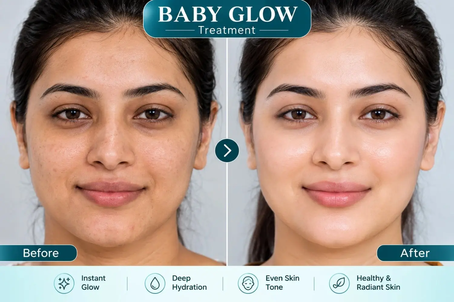 baby -glow treatment image