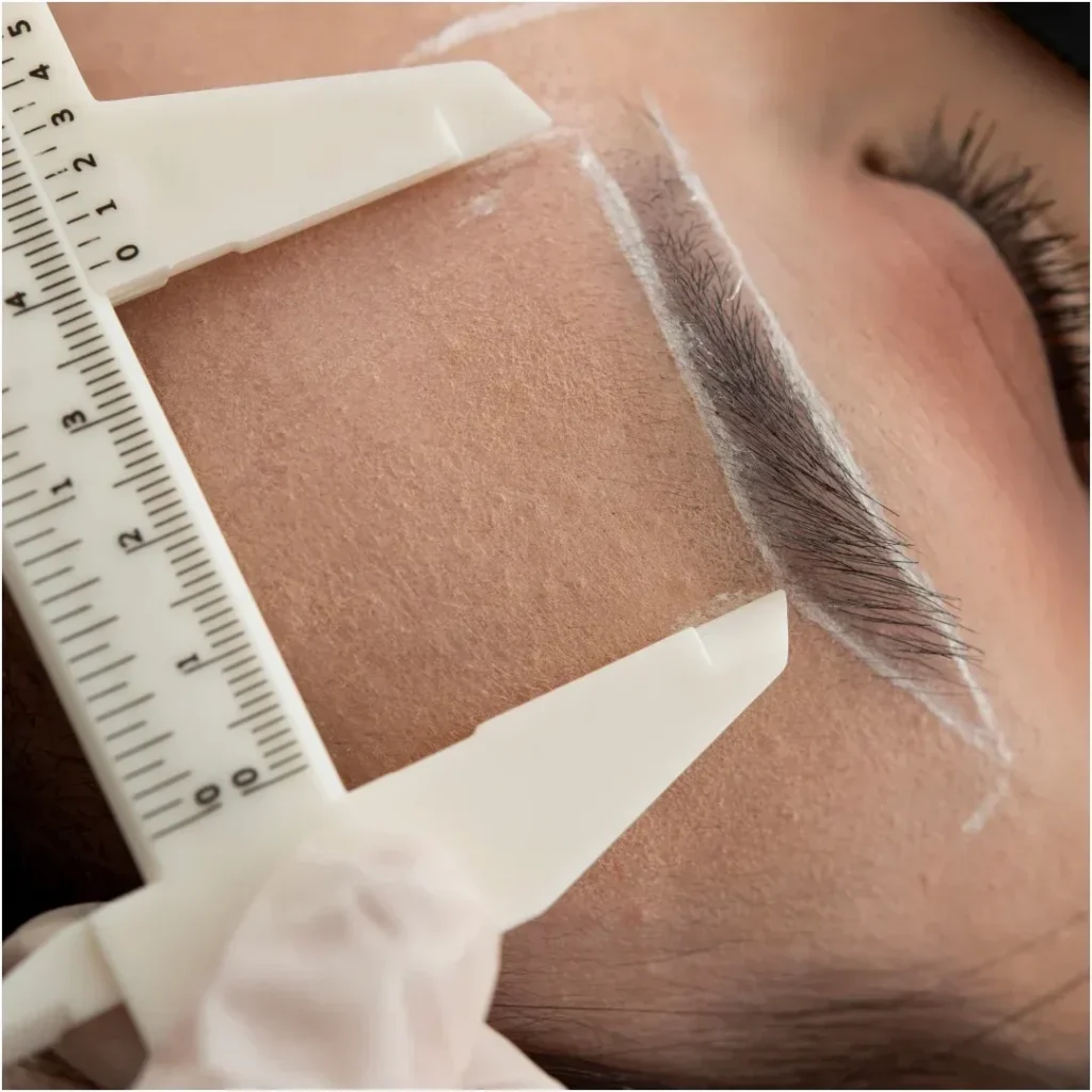 Brow lift treatment 01