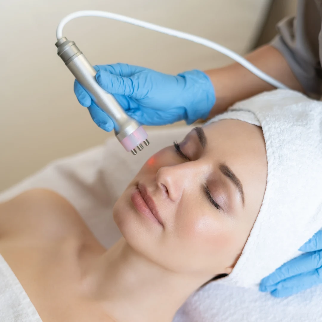 CO2 Laser Treatment 01