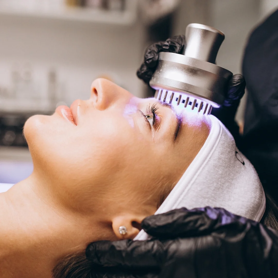 CO2 Laser Treatment 02