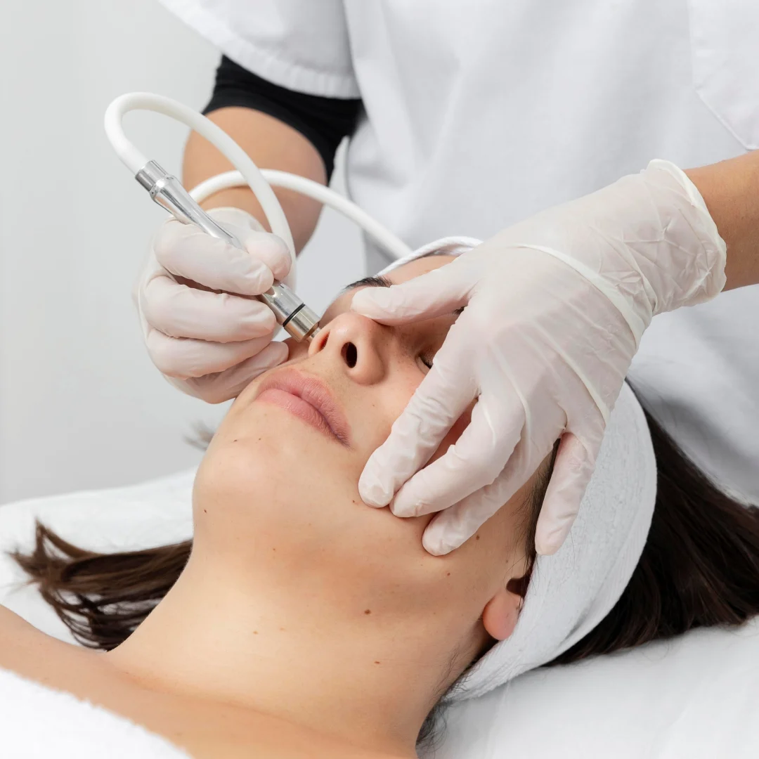 CO2 Laser Treatment 04
