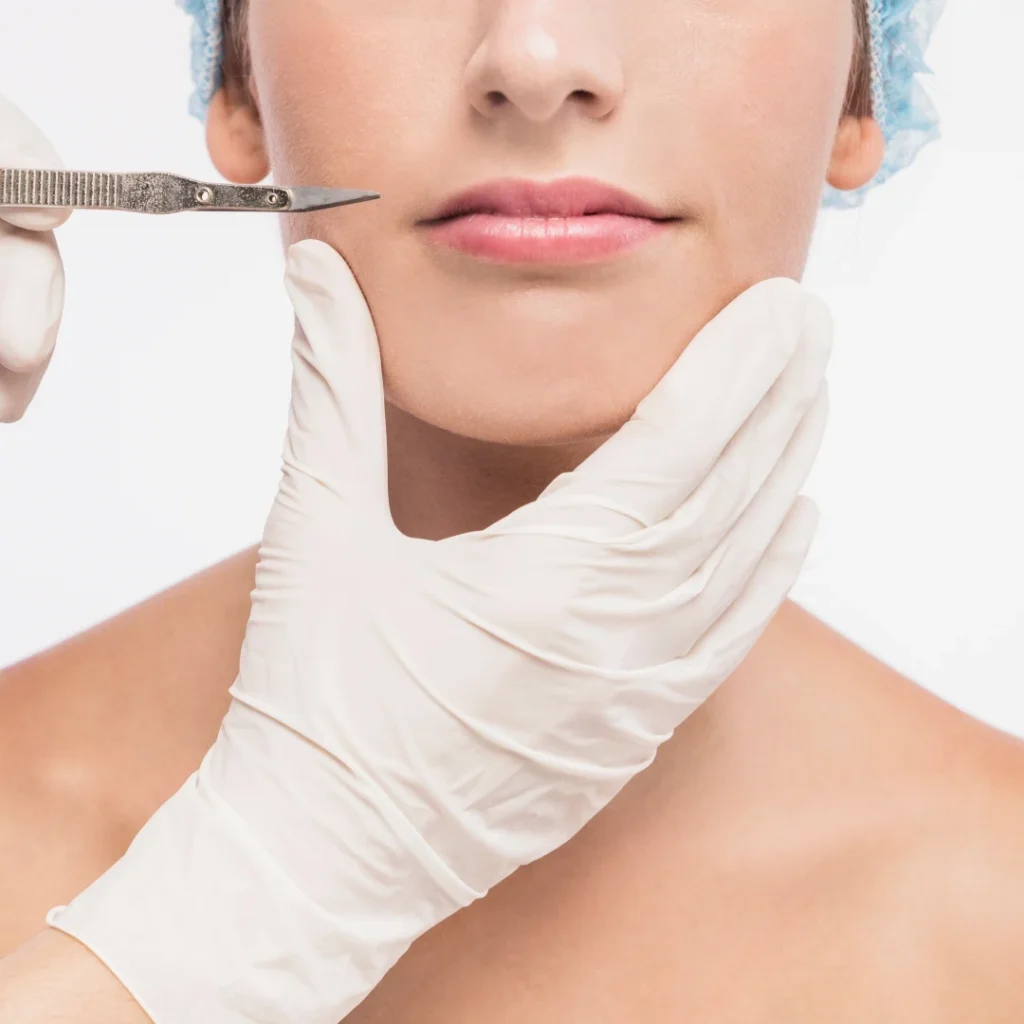 Chin Augmentation Implant Treatment 04